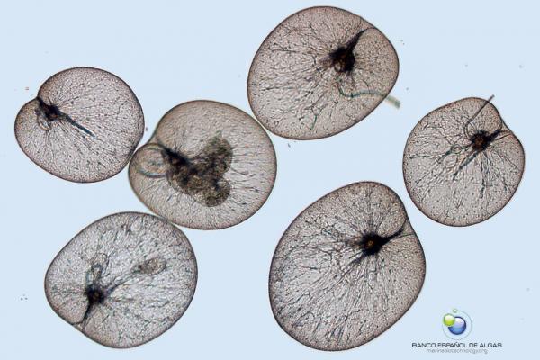 Vista microscópica de la microalga Noctiluca scintillans Macartney